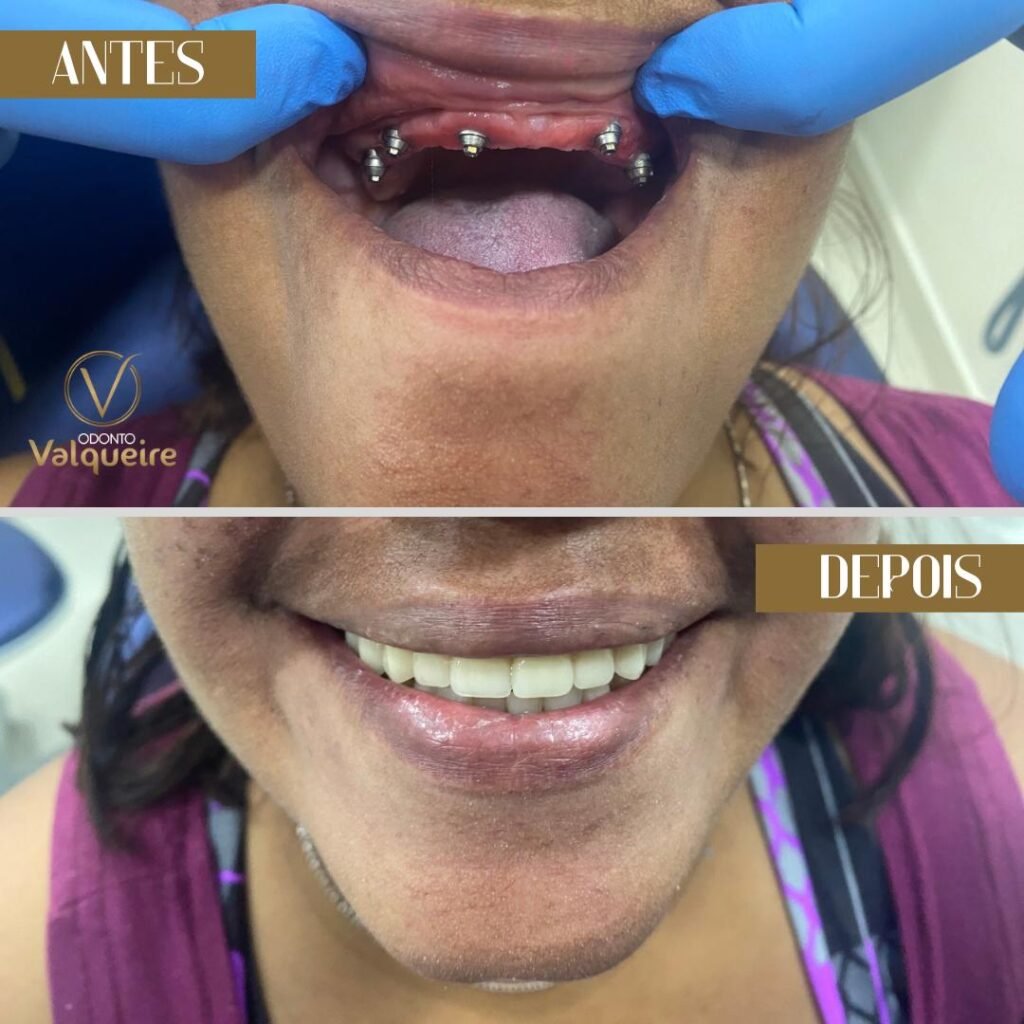 01 - ANTES E DEPOIS - 24.10