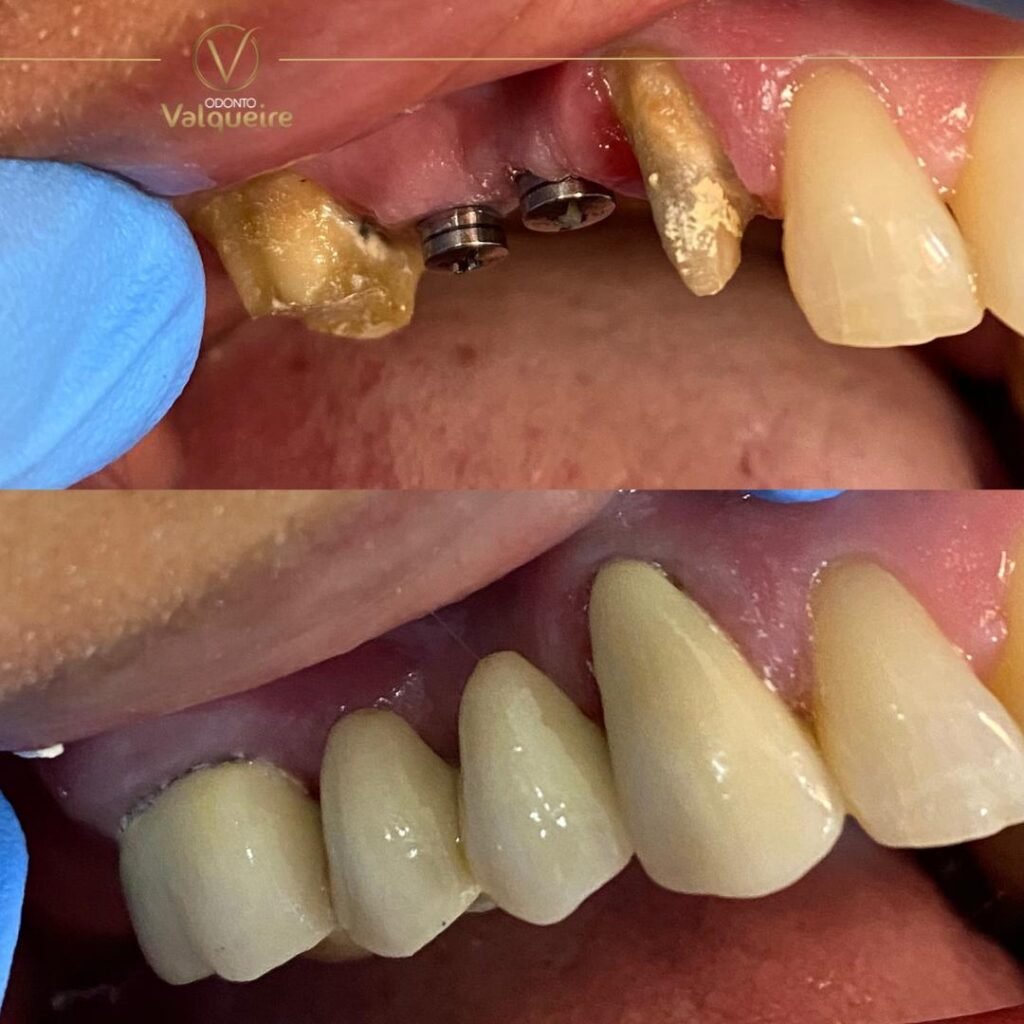03 - ANTES E DEPOIS - 24.10